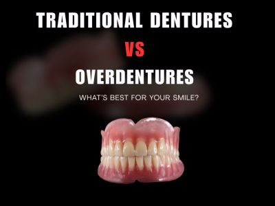 Traditional Dentures vs. Overdentures: A Comprehensive Guide